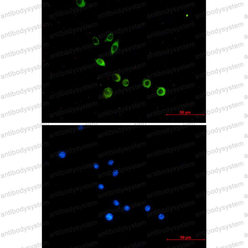 Anti-CD282/TLR2 Antibody (R1E72)