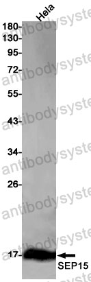 Anti-SELENOF Antibody (R1E74)