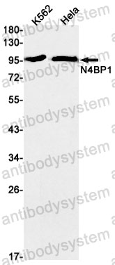 Anti-N4BP1 Antibody (R1F03)