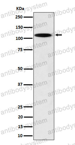 Anti-N4BP1 Antibody (R1F02)