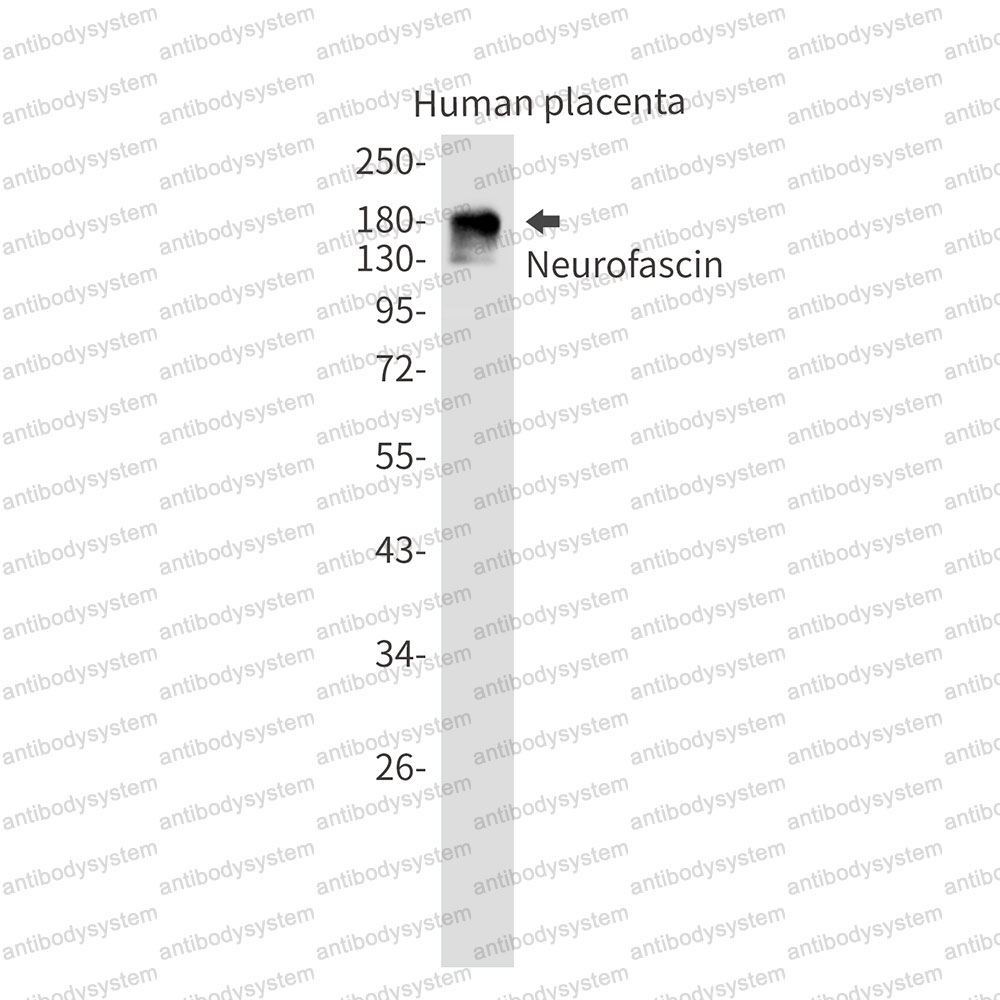 Anti-NFASC Antibody (R1G06)