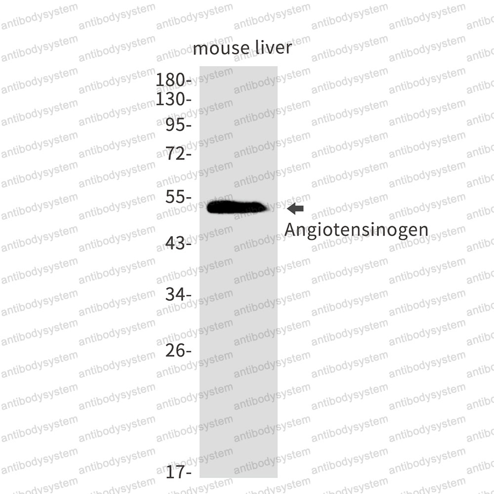 Anti-AGT Antibody (R1H56)