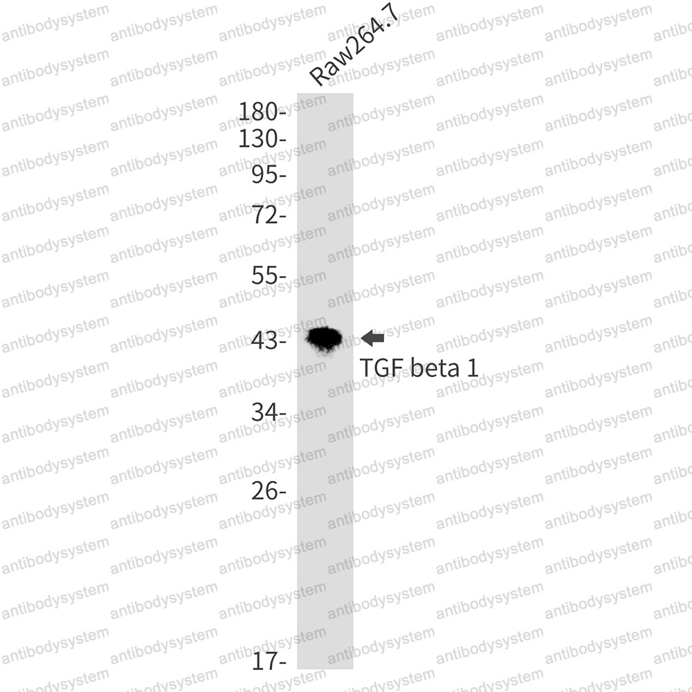 Anti-TGFB1/TGF-beta-1 Antibody (R1H74)