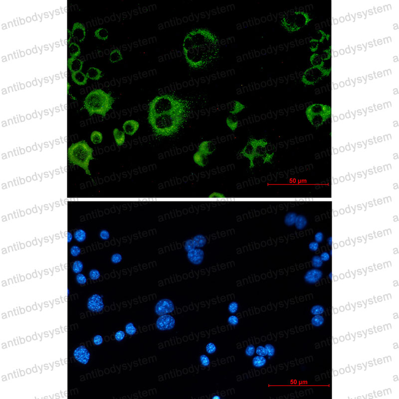 Anti-CAT/Catalase Antibody (R1J37)