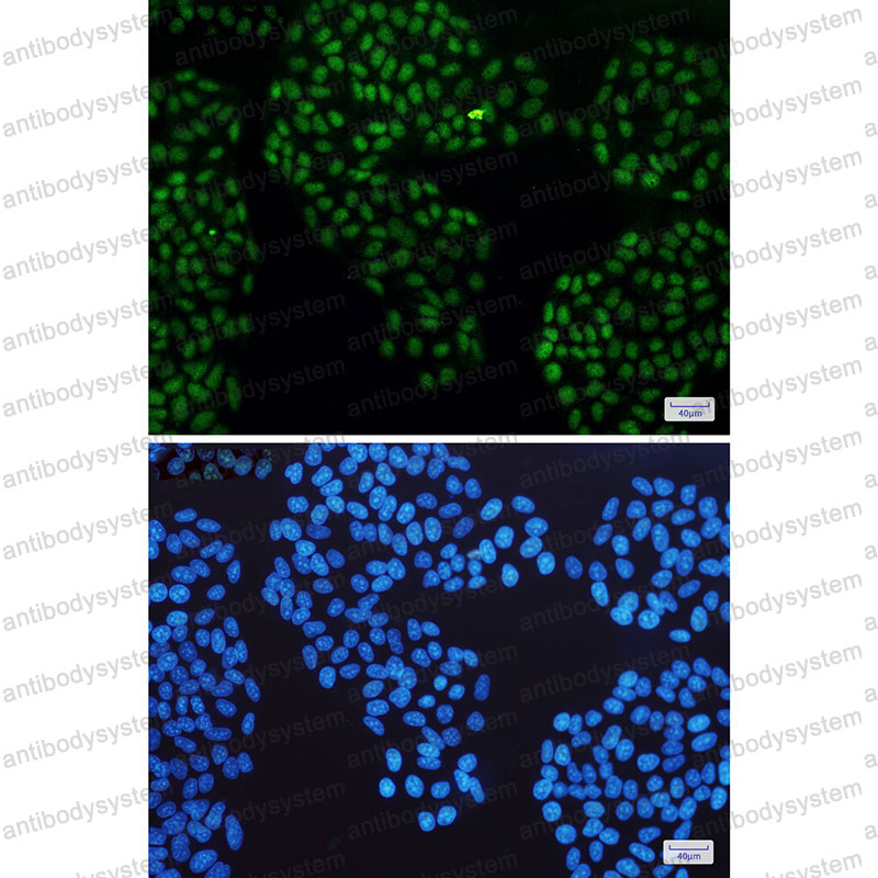 Anti-NR3C1 Antibody (R1J52)