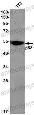 Anti-TP53/p53 Antibody (R1J72)