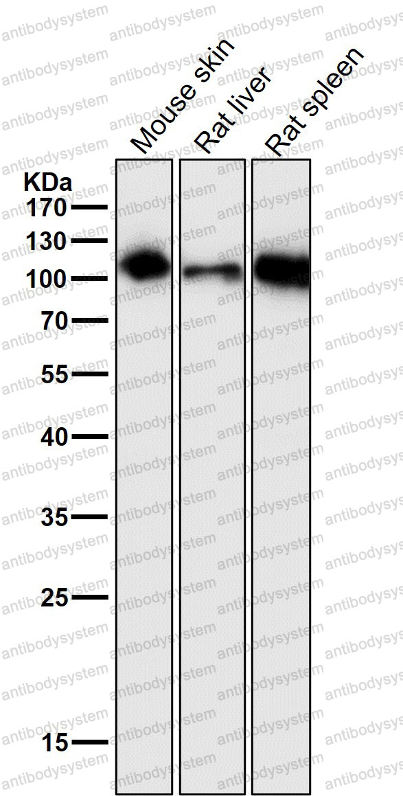 Anti-CD54/ICAM1 Antibody (R1K23)