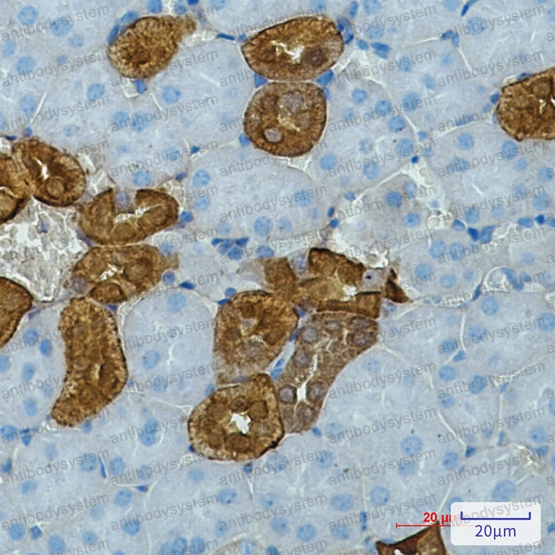 Anti-CALB1/Calbindin Antibody (R1K46)