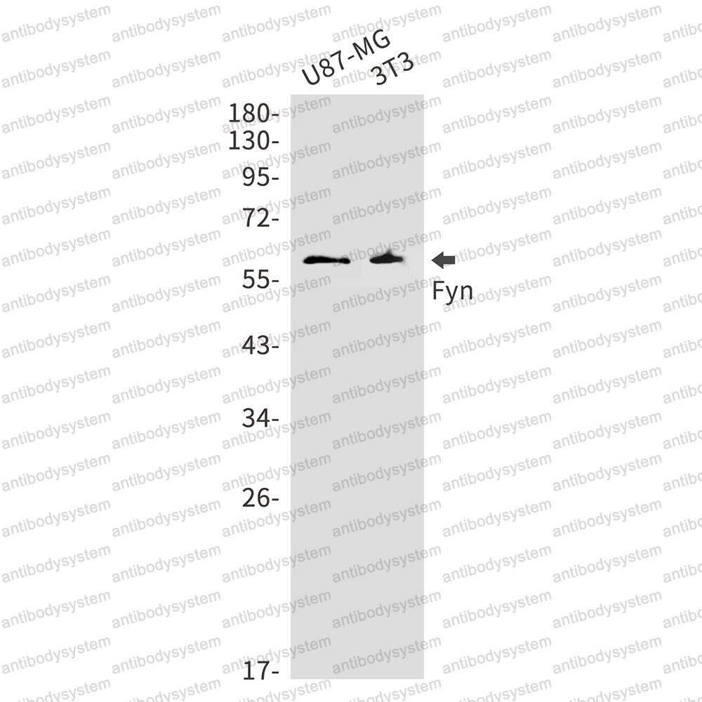 Anti-FYN Antibody (R1K48)