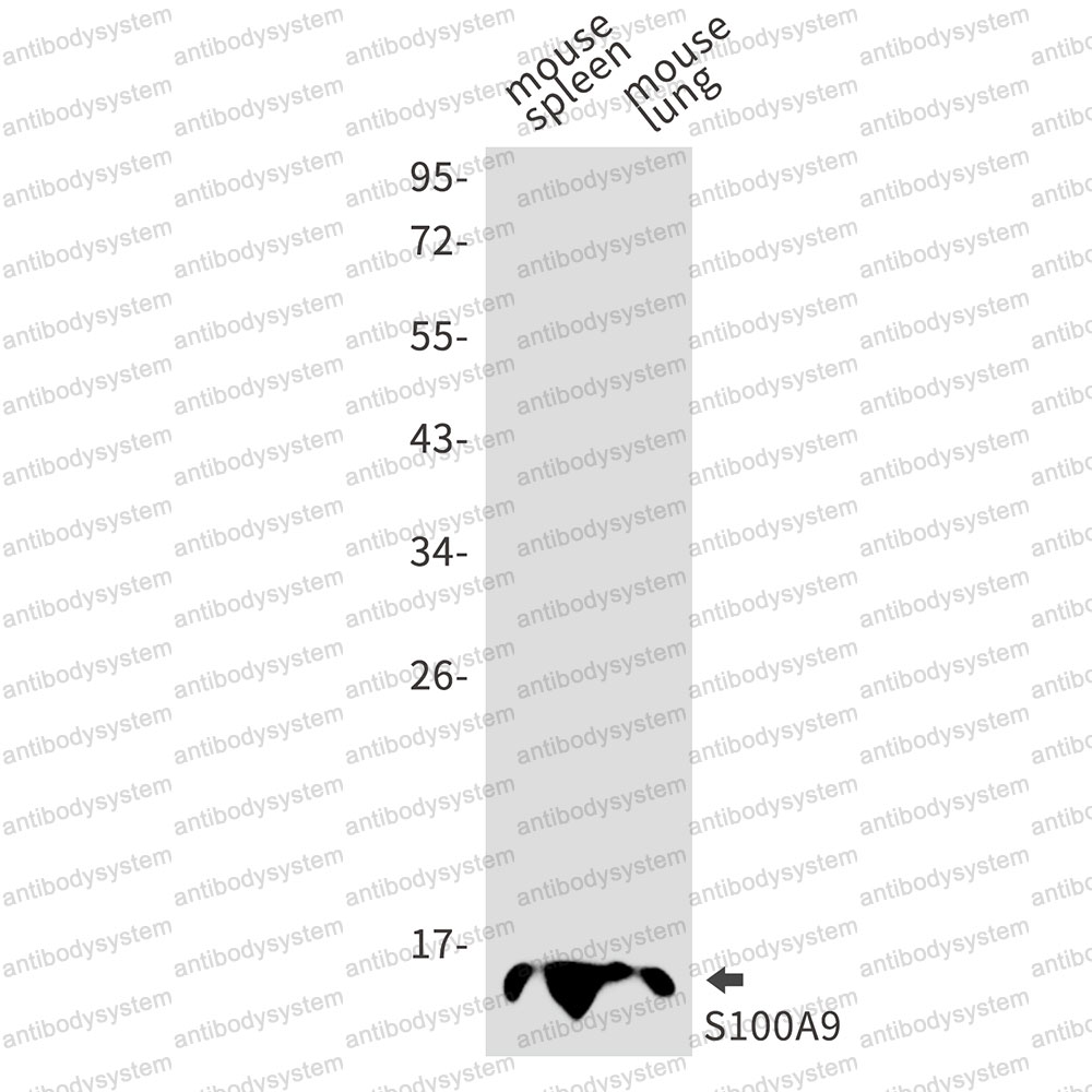 Anti-S100A9 Antibody (R1K70)