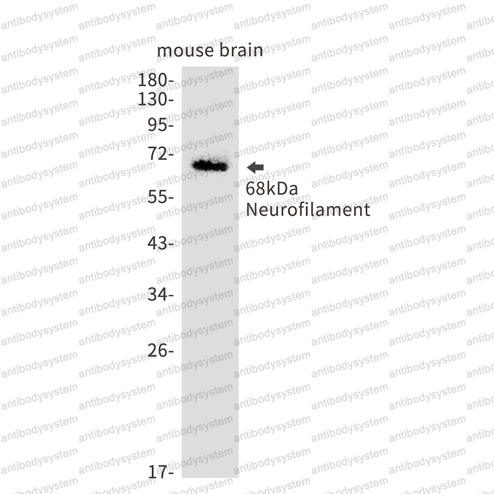 Anti-NEFL Antibody (R1K87)