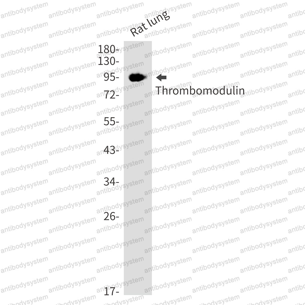 Anti-CD141/THBD Antibody (R1K95)