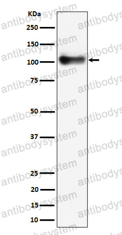 Anti-CD141/THBD Antibody (R1K93)