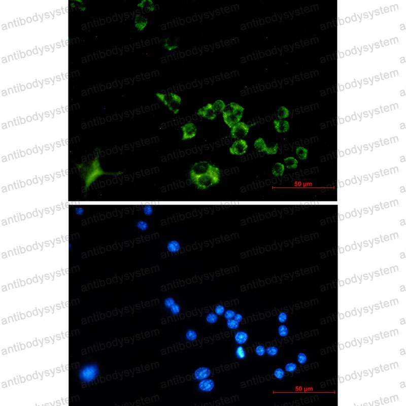 Anti-CTSB Antibody (R1L17)