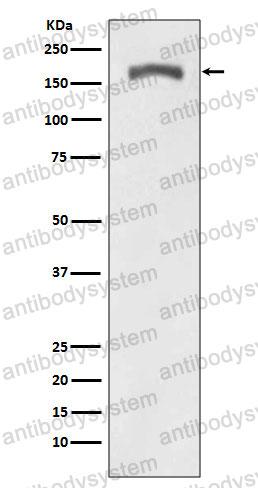 Anti-Phospho-CD140b/PDGFRB (Y740) Antibody (R1M18)