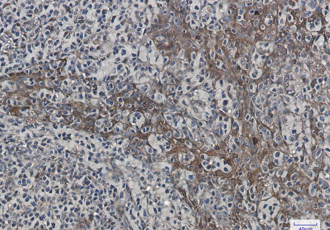 Anti-Hspa1b/HSP70.1 Antibody (R1M51)