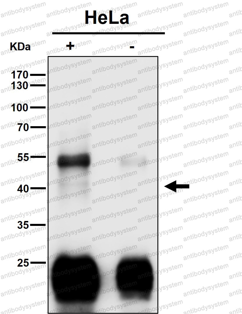 Anti-CLU/Clusterin Antibody (R1N15)