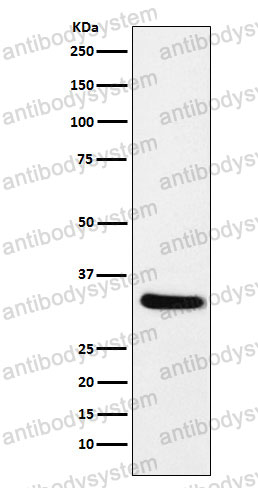 Anti-RLBP1 Antibody (R1N61)