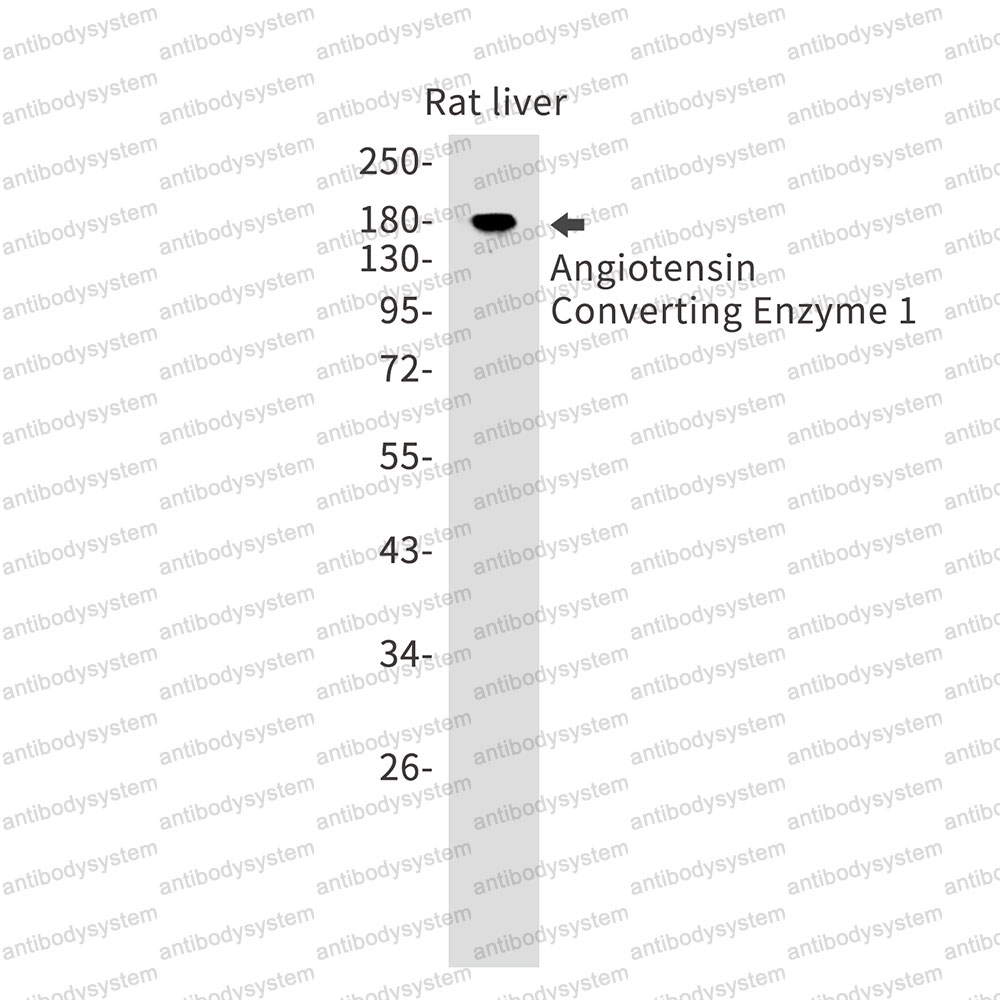 Anti-CD143/ACE Antibody (R1N72)