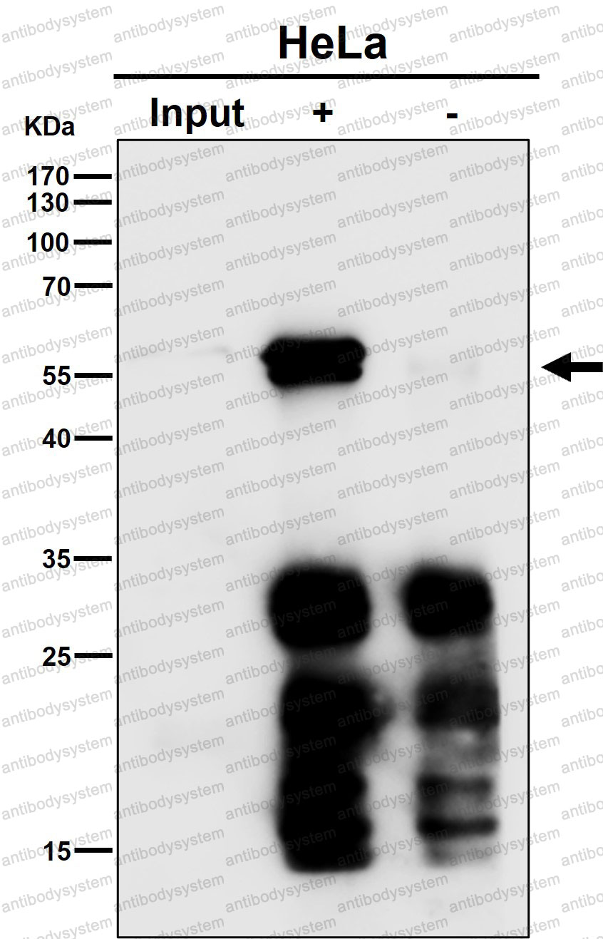 Anti-CD102/ICAM2 Antibody (R1N91)