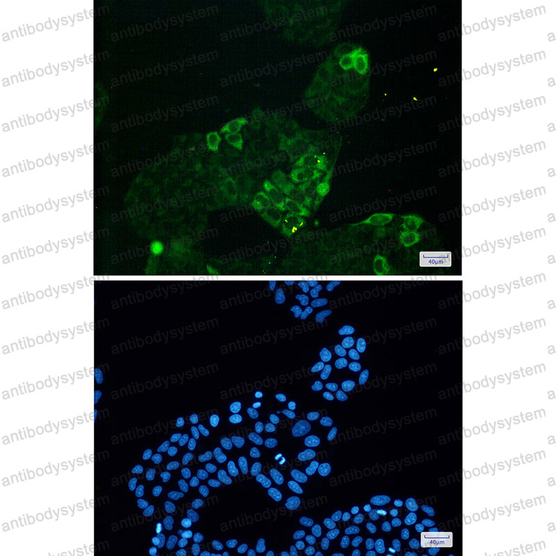 Anti-CCNB1 Antibody (R1P43)