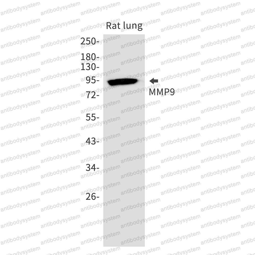 Anti-MMP9 Antibody (R1P48)