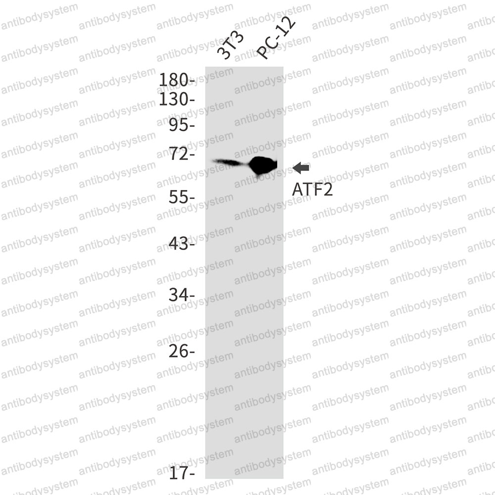Anti-ATF2 Antibody (R1P73)
