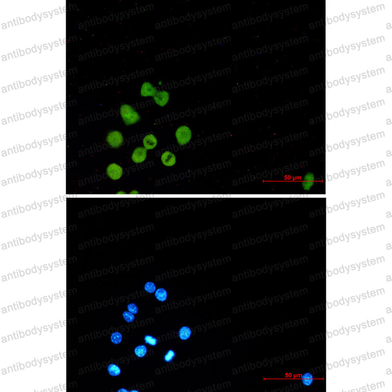 Anti-SPI1 Antibody (R1Q67)