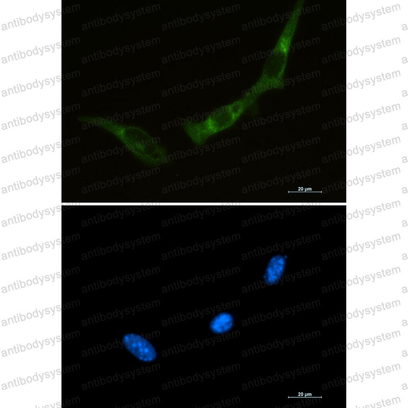 Anti-EIF2AK2 Antibody (R1R27)