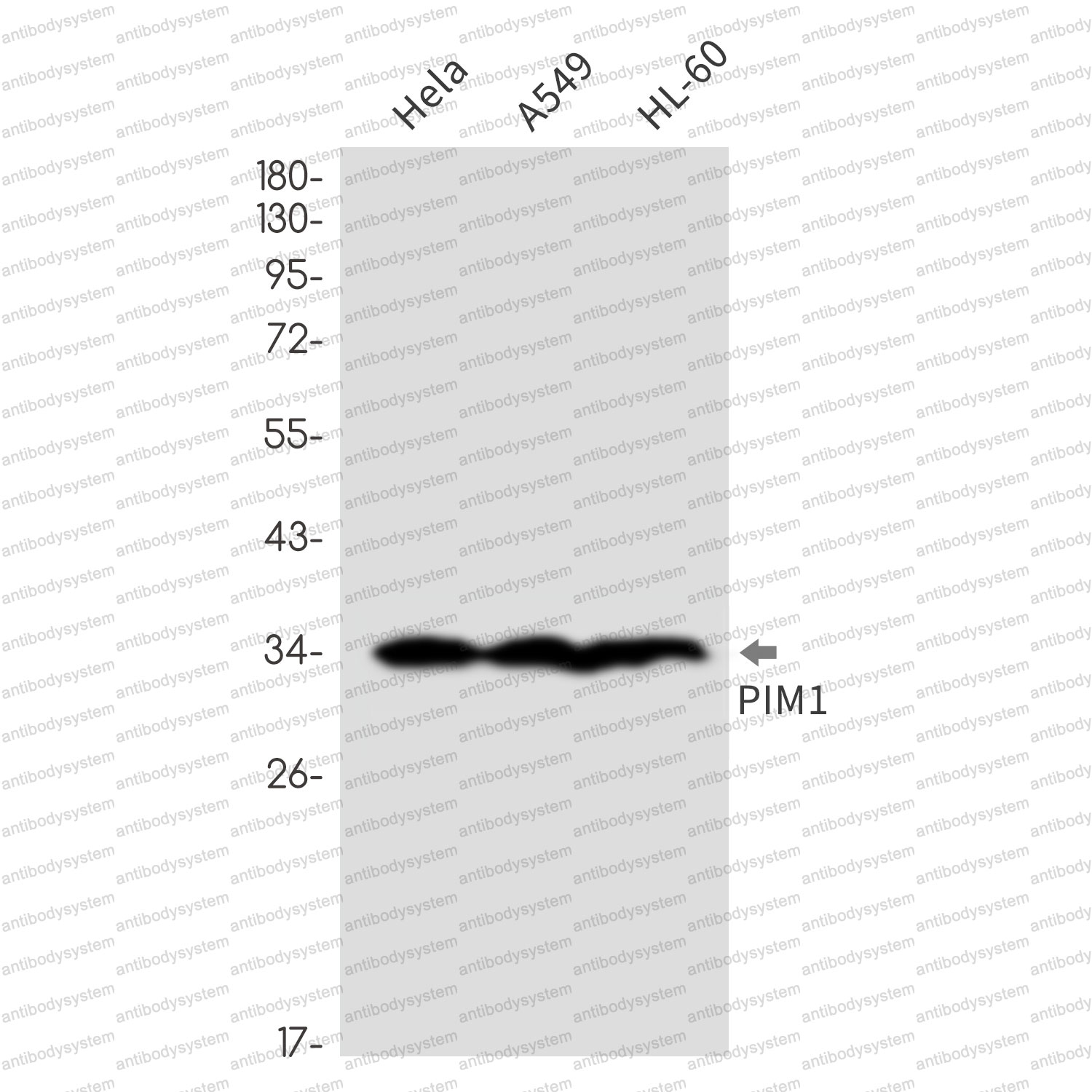 Western blot for Anti-CCNA2 Antibody (R1R47) ?>