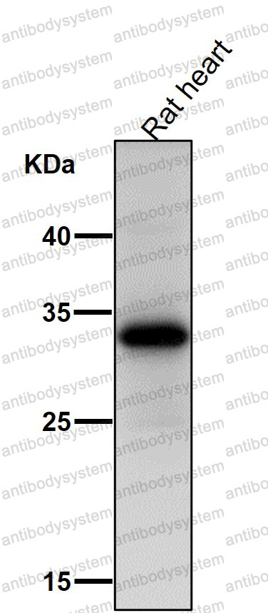 Anti-UCP1/3 Antibody (R1S93)