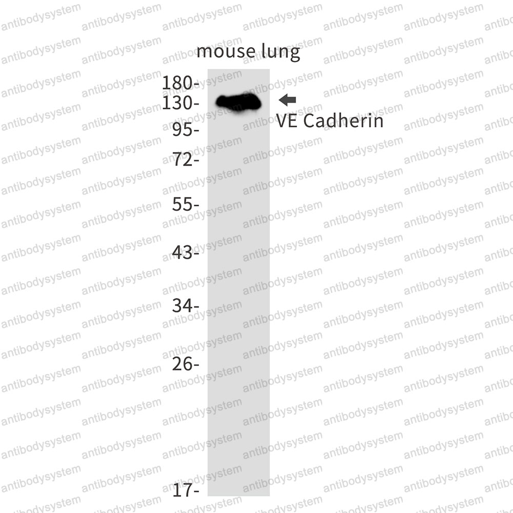 Anti-CD144/CDH5/VE-cadherin Antibody (R1U63)