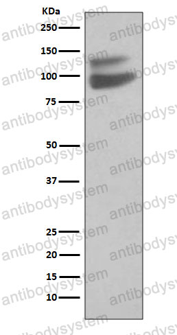 Anti-CD144/CDH5/VE-cadherin Antibody (R1U62)