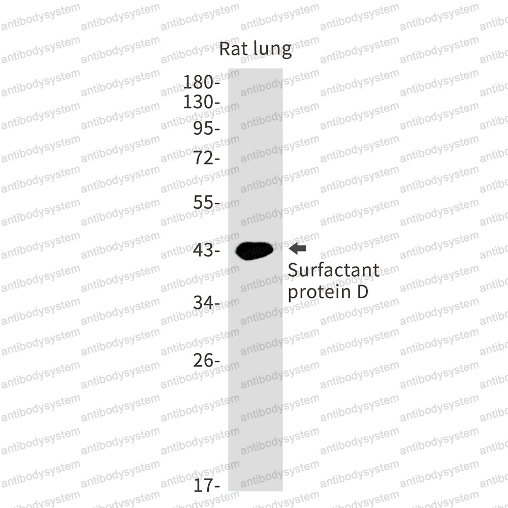 Anti-SFTPD Antibody (R1U94)