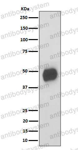 Anti-CD147/BSG Antibody (R1V17)