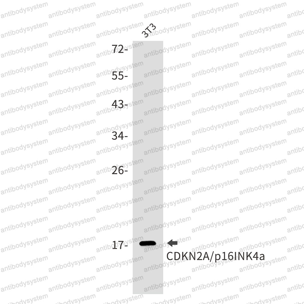 Anti-CDKN2A/p16INK4a Antibody (R1W28)