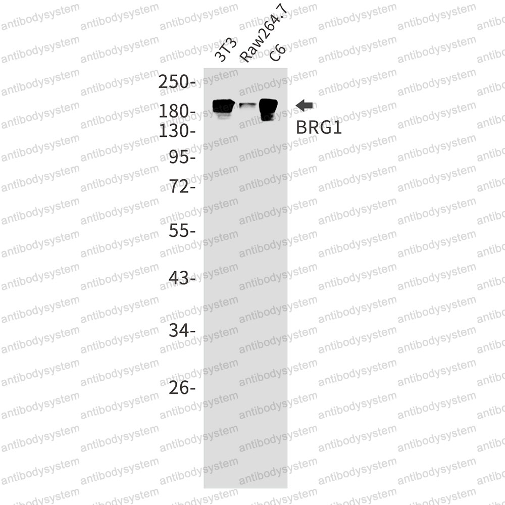 Anti-BRG1/SMARCA4 Antibody (R1Y26)