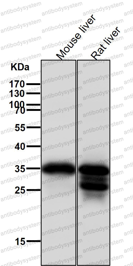 Anti-CASP7 Antibody (R1Z21)