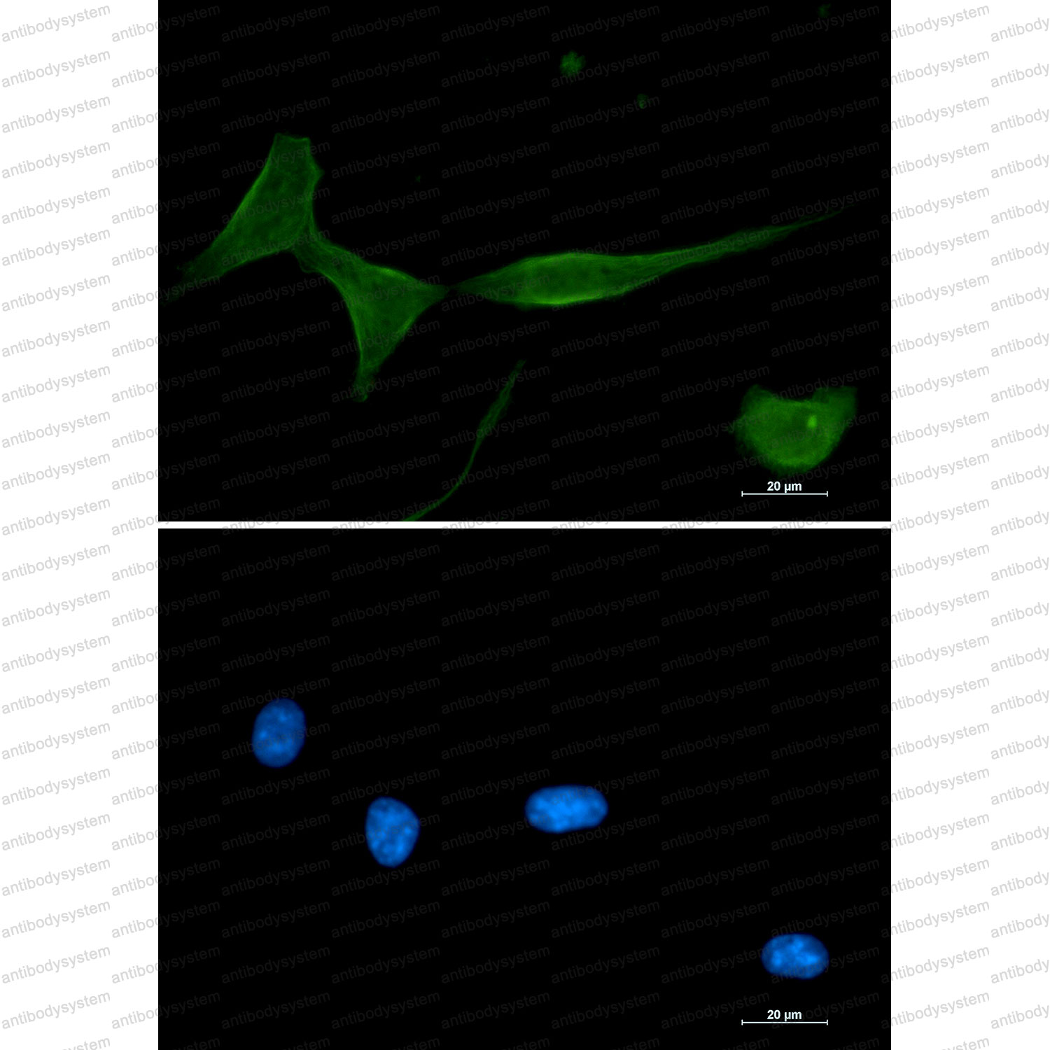 Anti-PRKCD/PKC delta Antibody (R2C72)