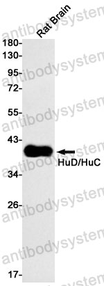 Anti-HuC/HuD Antibody (R2F58)