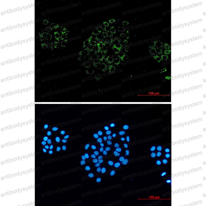 Anti-ACOX1 Antibody (R2F95)