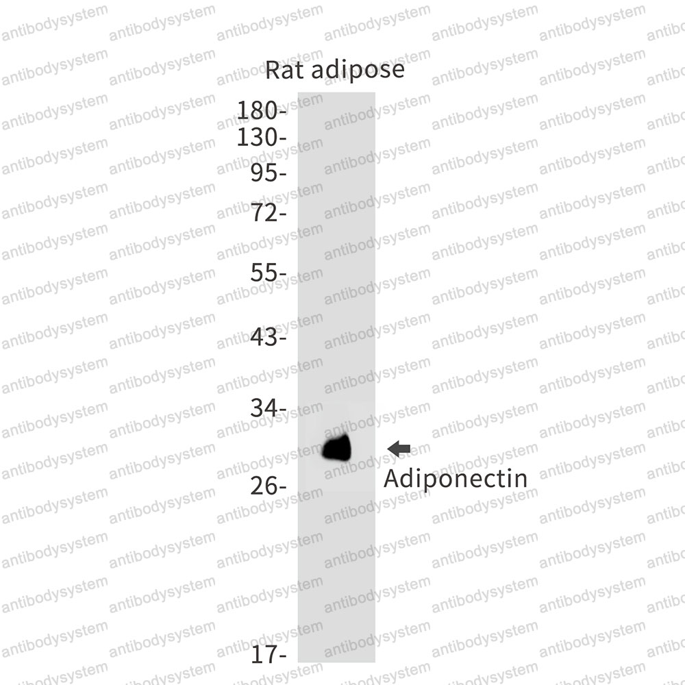 Anti-Adiponectin/ACRP30/ADIPOQ Antibody (R2G76)