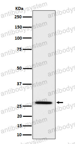 Anti-Adiponectin/ACRP30/ADIPOQ Antibody (R2G74)