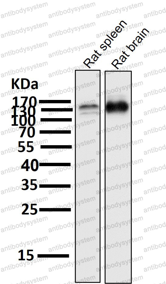 Anti-TrkB /NTRK2 Antibody (R2H18)