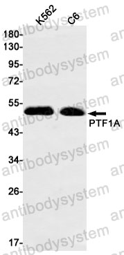 Anti-PTF1A Antibody (R2H95)