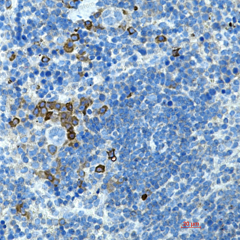 Anti-CD272/BTLA Antibody (R2H96)