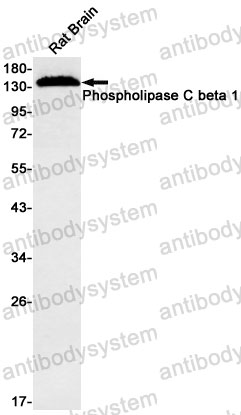 Anti-PLCB1 Antibody (R2K36)