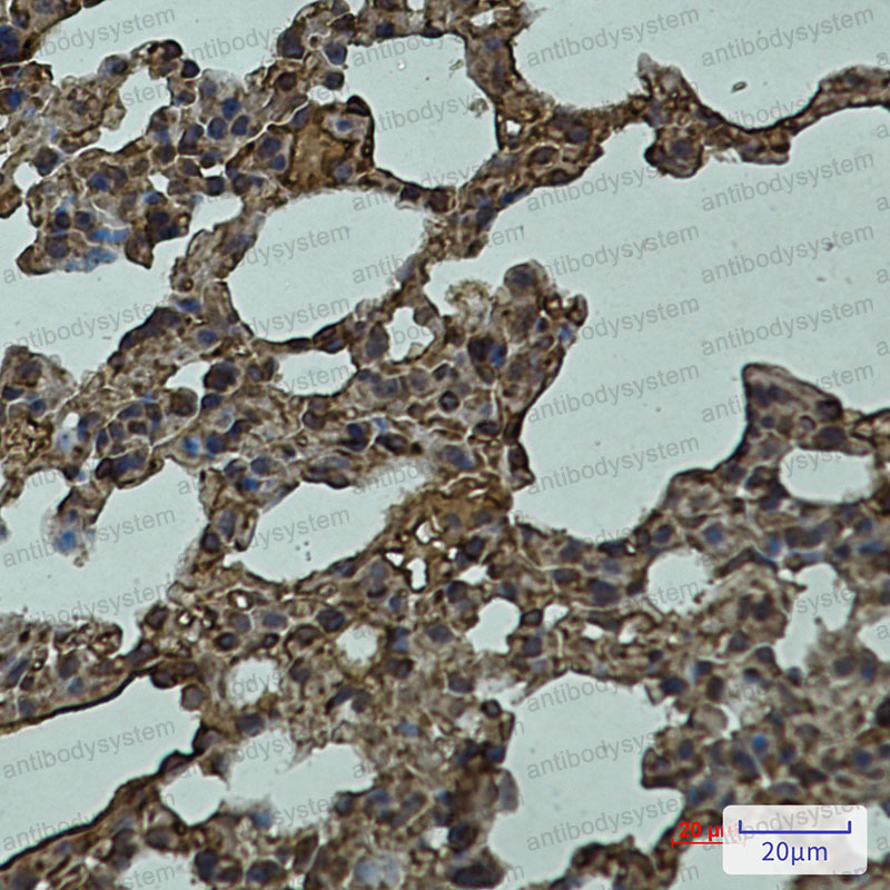 Anti-LYVE1 Antibody (R2L24)