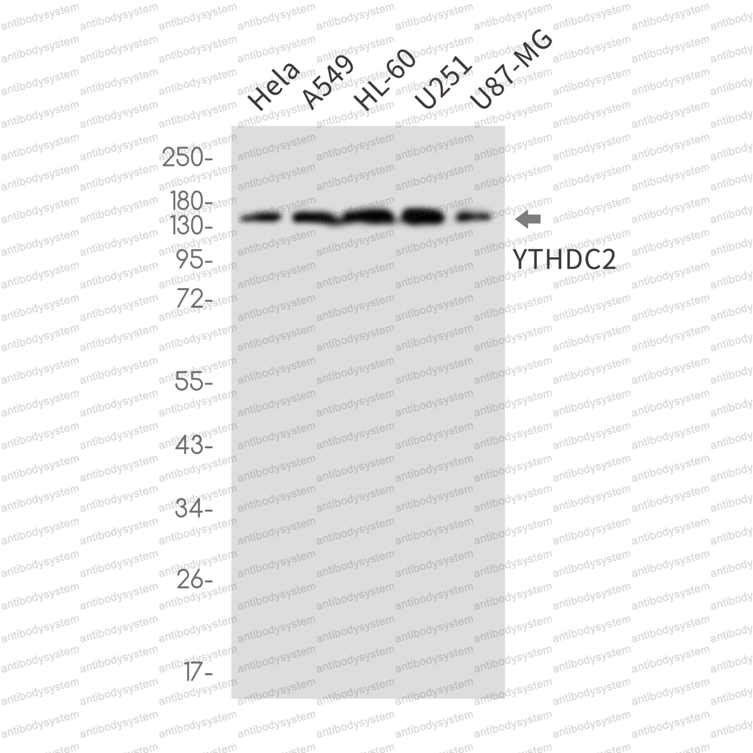 Anti-YTHDC2 Antibody (R2M28)