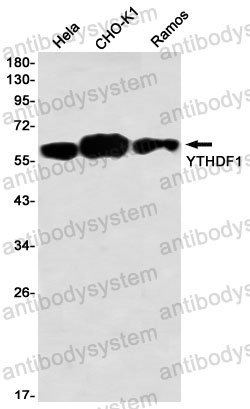 Anti-YTHDF1 Antibody (R2N97)